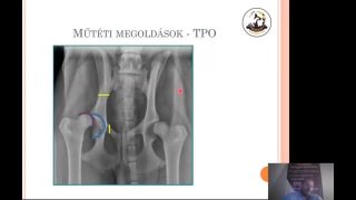 Mozgásszervi megbetegedések – Műtéti eljárások